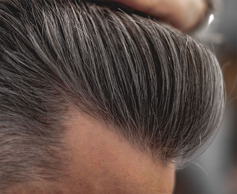Non-Surgical Hair Replacement by Folicure Hair Replacement in Dallas, Texas