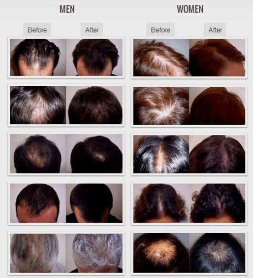 Trichology Hair Loss Prevention Clinic — sew-in stylist in Winston-salem, North Carolina